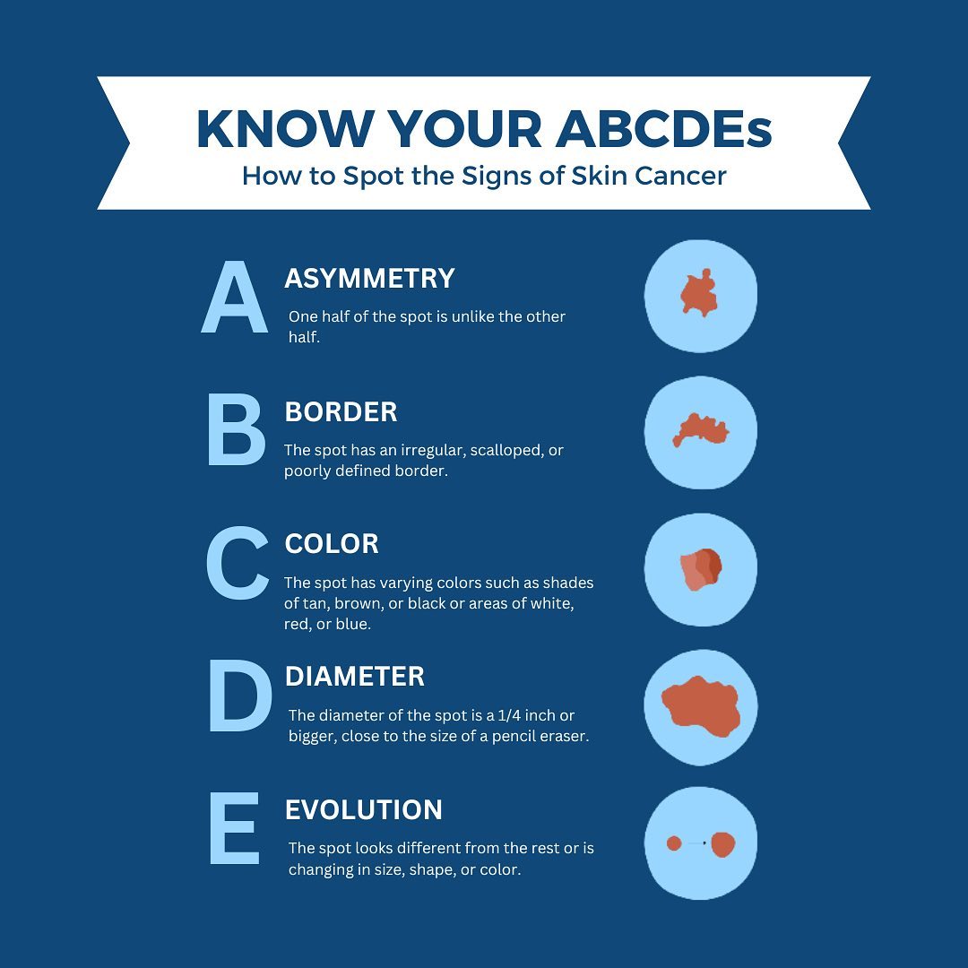 National Cancer Prevention Month: A Focus on Skin Cancers - DR. NOVIKOV ...