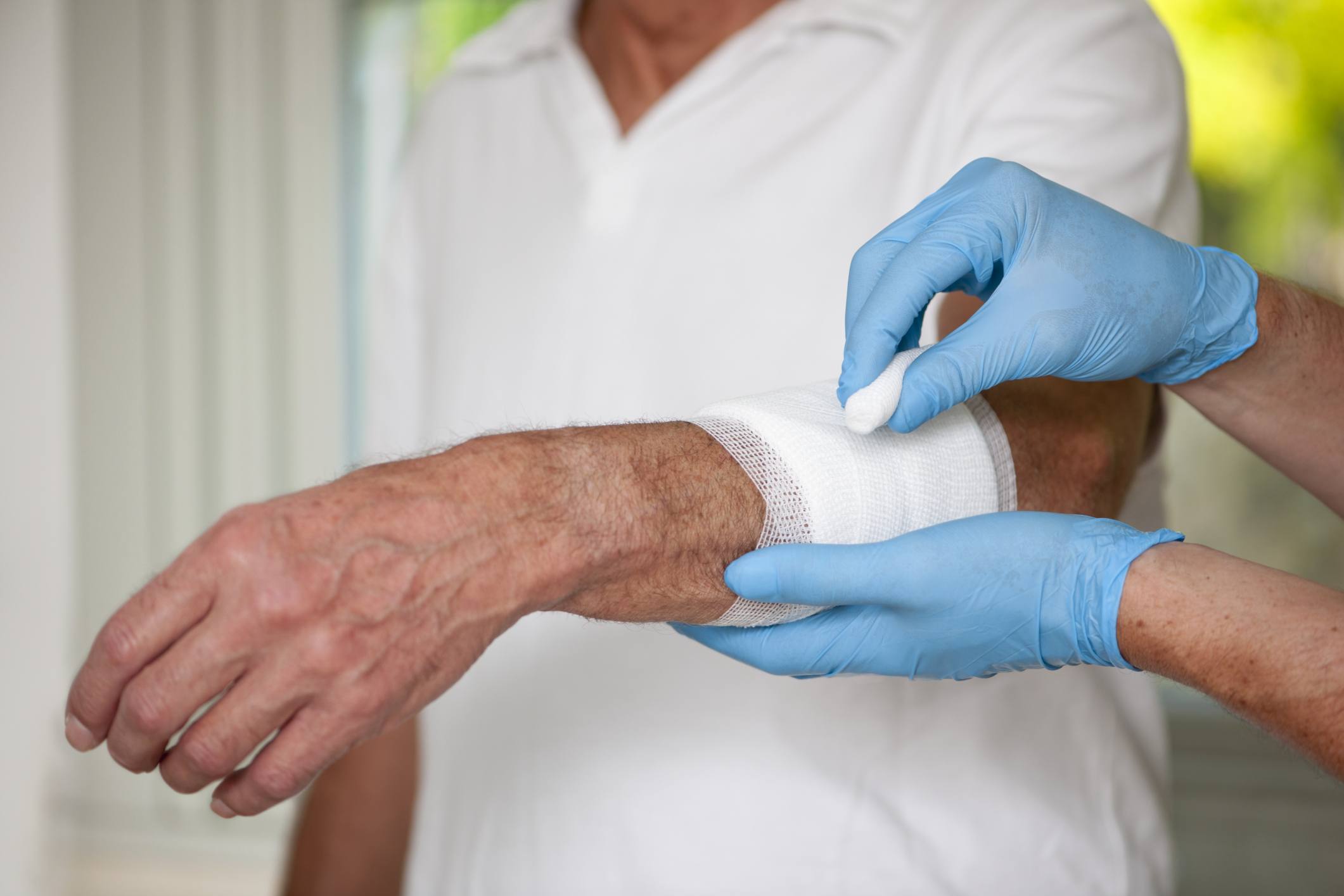 Skin Riping What are skin tears? - DR. NOVIKOV WELLNESS AND SKIN CARE